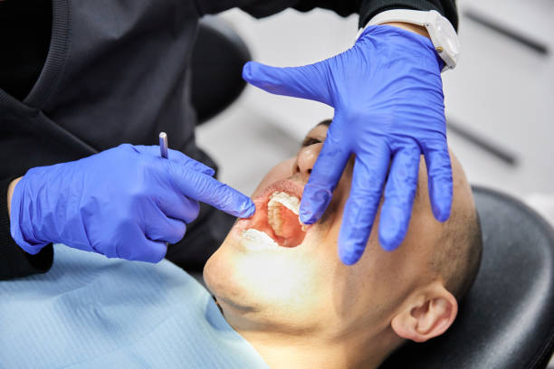 Best Emergency Treatment for Dental Infections or Abscesses in Hugo, MN